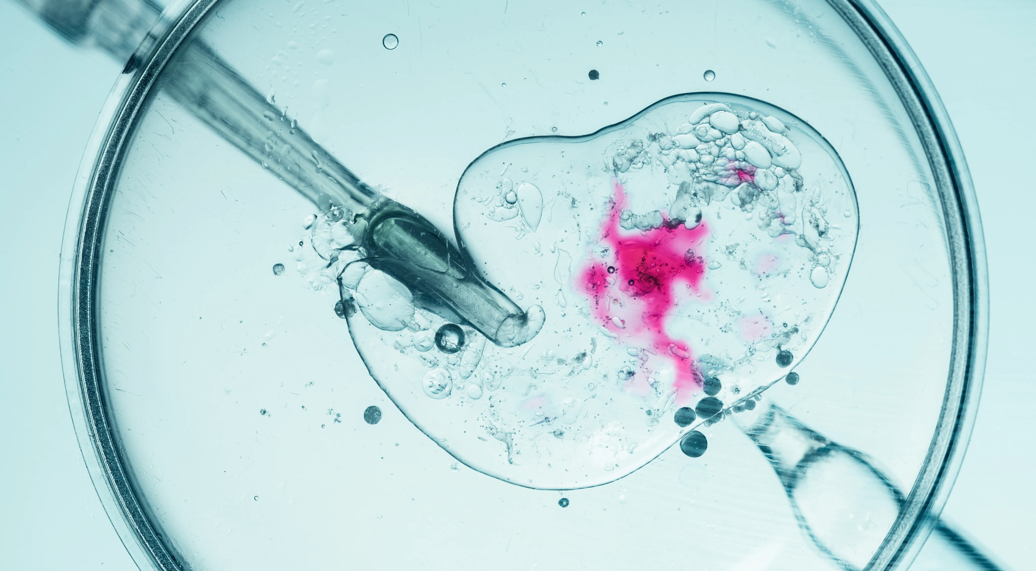 Medicated cycle transfer 1