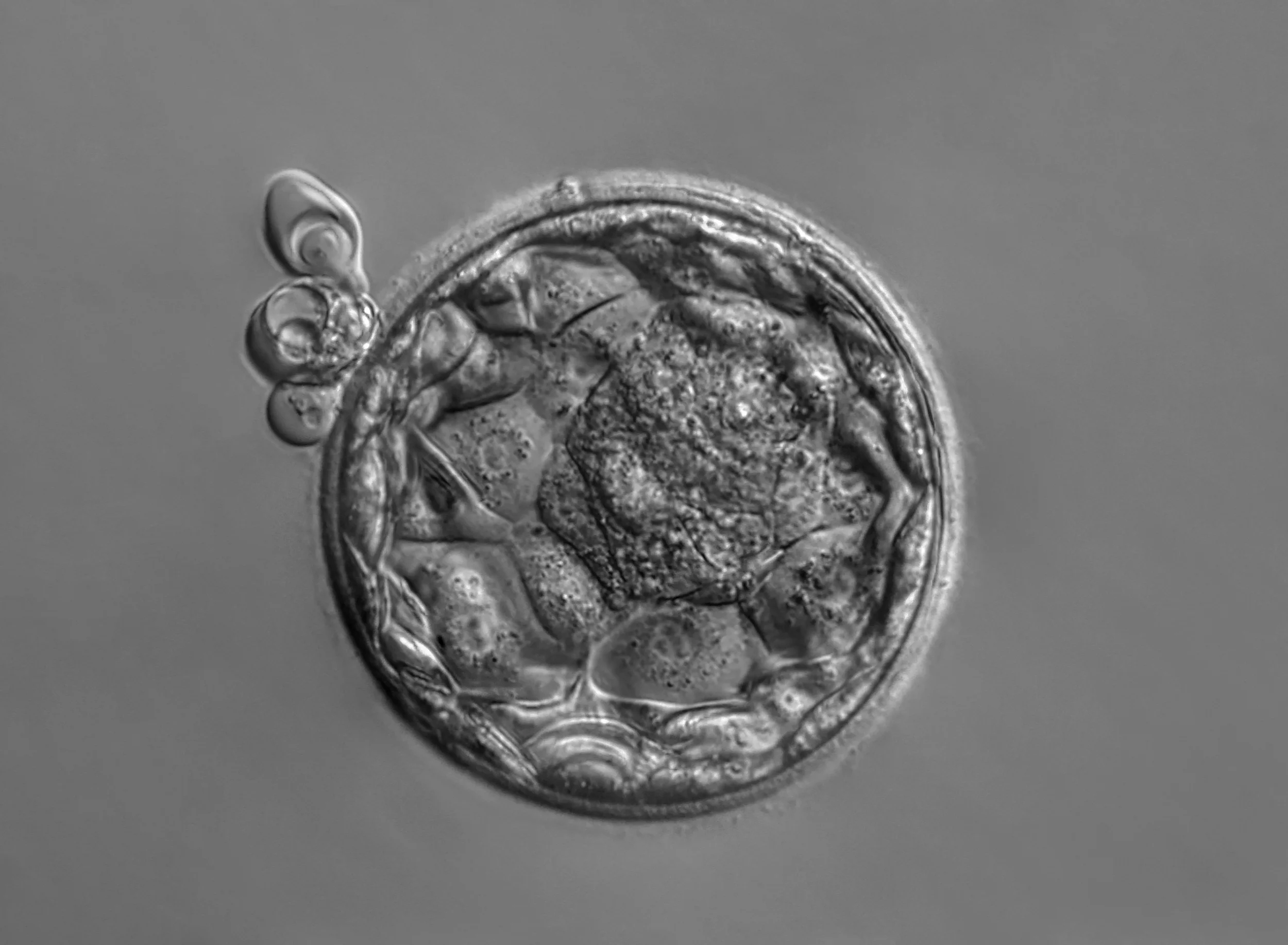 Medicated cycle transfer 2